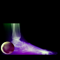 perex image