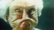obr�zek k �l�nku Bezzub� d�sn�? Krajn� d�sledek sk��p�n� zub�