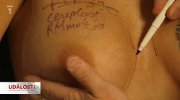 obr�zek k �l�nku Implant�ty za vy��� sledovanost Ud�lost�!