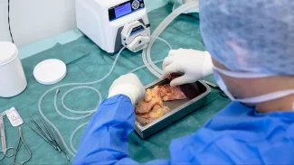 Transplantace Langerhansových ostrůvků nahrazuje slinivku, separátor upravovali „na koleně“