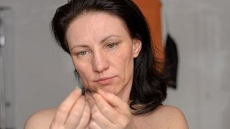 Za padání vlasů může i covid, upozorňuje specialistka. Náprava může trvat měsíce