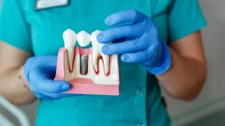 Ani ty nejlepší implantáty se funkčně nevyrovnají zubu. I s nimi se taky musí na kontroly