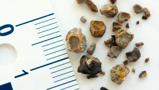 Pokud jsou ledvinové kameny malé, nemusíte o nich vědět. Větší už způsobují bolest