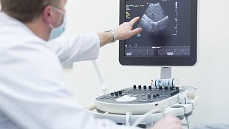 Ultrazvuk odhaluje zdravotní potíže a umí i léčit. Poradí si třeba s ledvinovými kameny