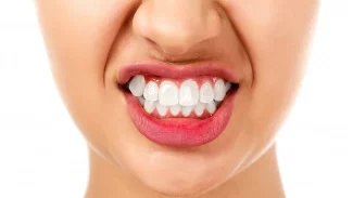 Se skřípáním zubů pomůže botulotoxin. Lidé si však musí zákrok zaplatit, efekt je navíc dočasný