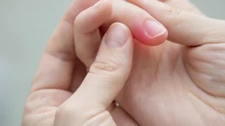 Absces byste neměli podceňovat, může vést k sepsi. Léčí se vypuštěním hnisu a antibiotiky