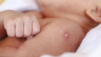 Plošné očkování proti tuberkulóze není třeba. Vzniká ale vakcína bez jizvičky na paži