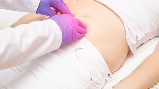 Trápila ji zácpa a bolesti břicha. Nešlo o zažívání, projevila se tak rakovina vaječníků