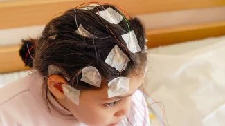 Operace umí zbavit děti epilepsie, mohou pak žít stejně jako jejich vrstevníci