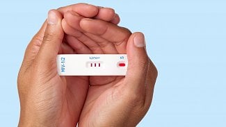 Léky chránící před HIV jsou nově i v injekcích. Nakažených je přes pět tisíc