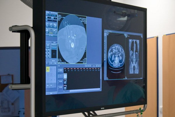 Aplikace elektrochemoterapie v MOÚ