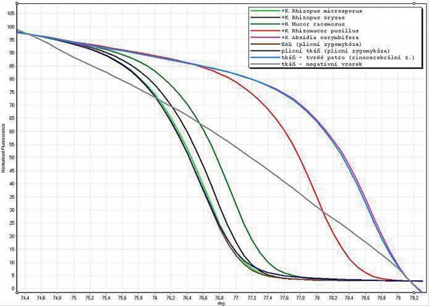Obr. 3 – Normalizované HRM křivky získané metodou seminested real-time PCR specifické pro zygomycety – z archívu Centra molekulární biologie a genové terapie při IHOK LF MU a FN Brno