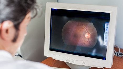 Hrazené preventivní vyšetření očí nabídnou diabetologové za několik měsíců