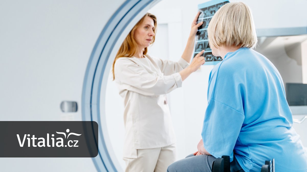 Jaké screeningy vám lékař doporučí po padesátce