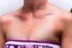 Mezi další symptomy, které jsou pro růži charakteristické, patří především horečka. Tu může občas doprovázet zimnice a dále je to třes, celková slabost anebo problémy trávicí soustavy.
