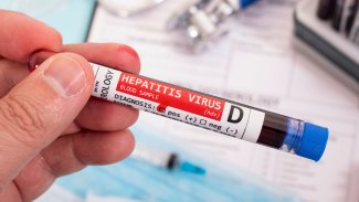 Náhledový obrázek - Hepatitida D je zvláštním druhem infekční žloutenky. K rozvoji vyžaduje přítomnost hepatitidy B