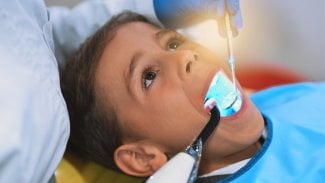 Zubař vytvrzuje UV světlem dítěti fotokompozitní plombu