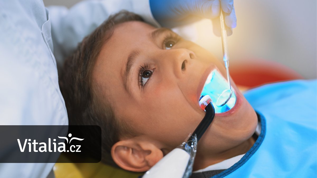 Pojišťovny od ledna přispějí na bílé plomby. Jednou za dva roky na každý zub