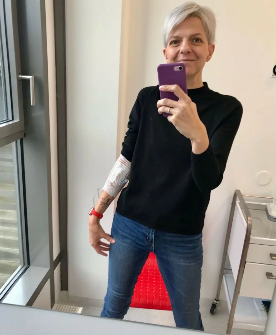 S revmatoidní artritidou bývá často spojená i osteoporóza – řídnutí kostí. Projevuje se zlomeninami i po drobných úrazech, někdy dokonce bez úrazového děje. Tato nemoc je bezpříznaková, a tak na ni pacienty dopředu nic neupozorňuje.