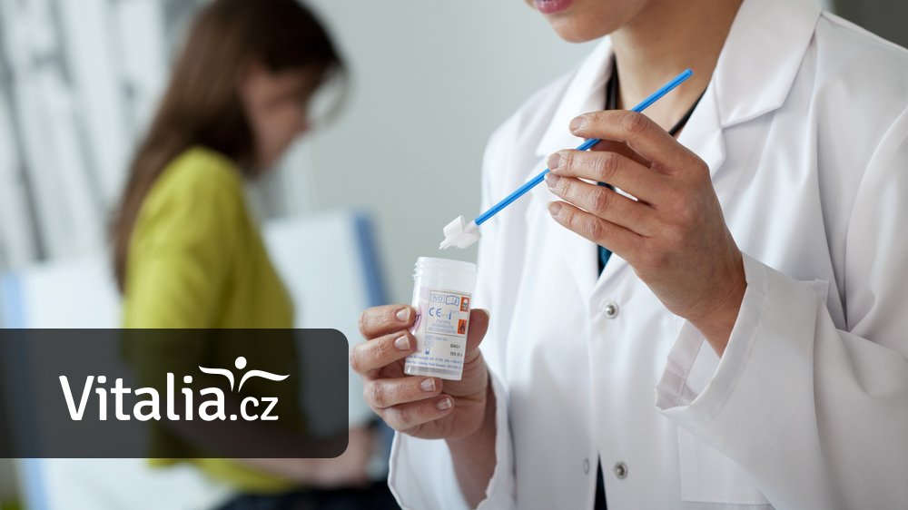 Lékaři chtějí změnu prevence nádoru čípku. Ta současná více než pětinu případů neodhalí