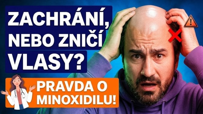 Nadměrné vypadávání vlasů: účinky minoxidilu