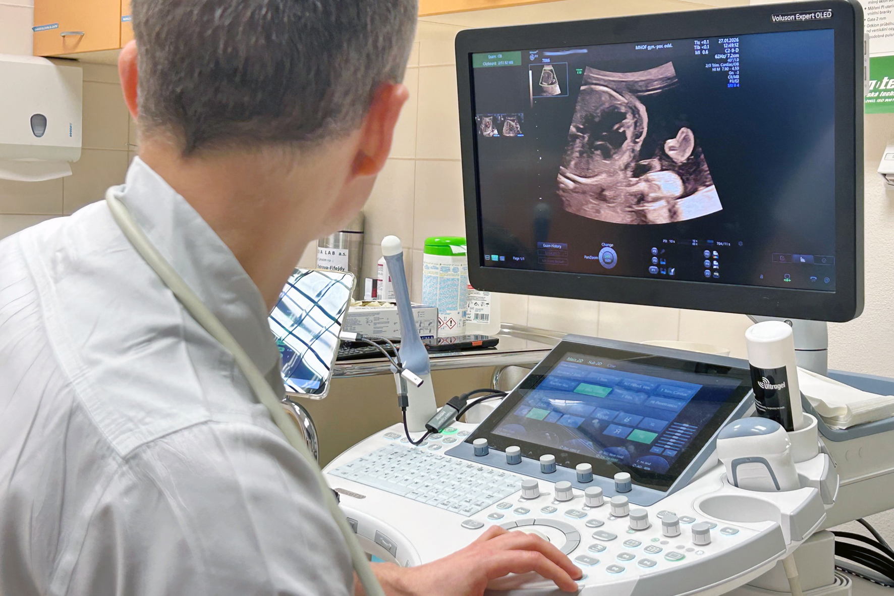 Technologie Fetoly v Městské nemocnici Ostrava