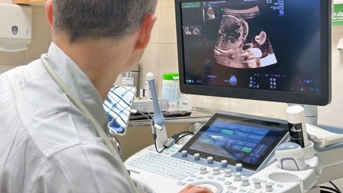 Technologie Fetoly v Městské nemocnici Ostrava