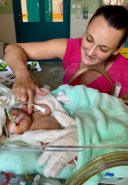 Maminka s jedním z dvojčat, jež přišla na svět s brániční kýlou