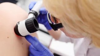Basaliom je nejčastěji se vyskytující nádor na kůži. Ačkoliv je zhoubný, jen zřídkakdy metastazuje