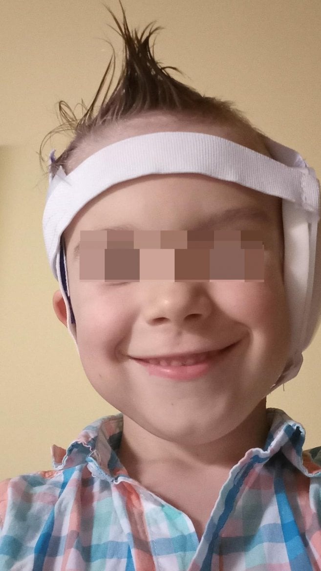 Jonáš, druhé dítě odoperované v ČR metodou Sheryl Lewinové