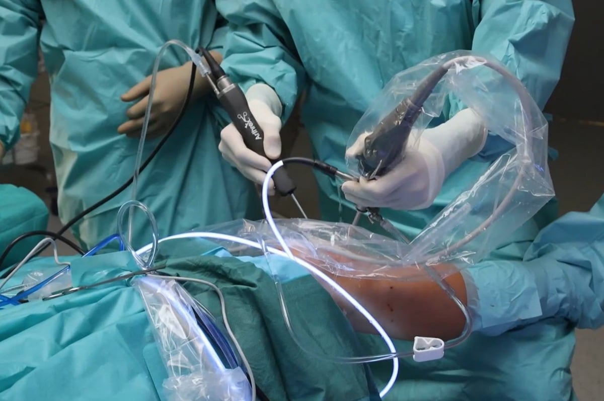 Unikátní operace kolene ve FN Hradec Králové