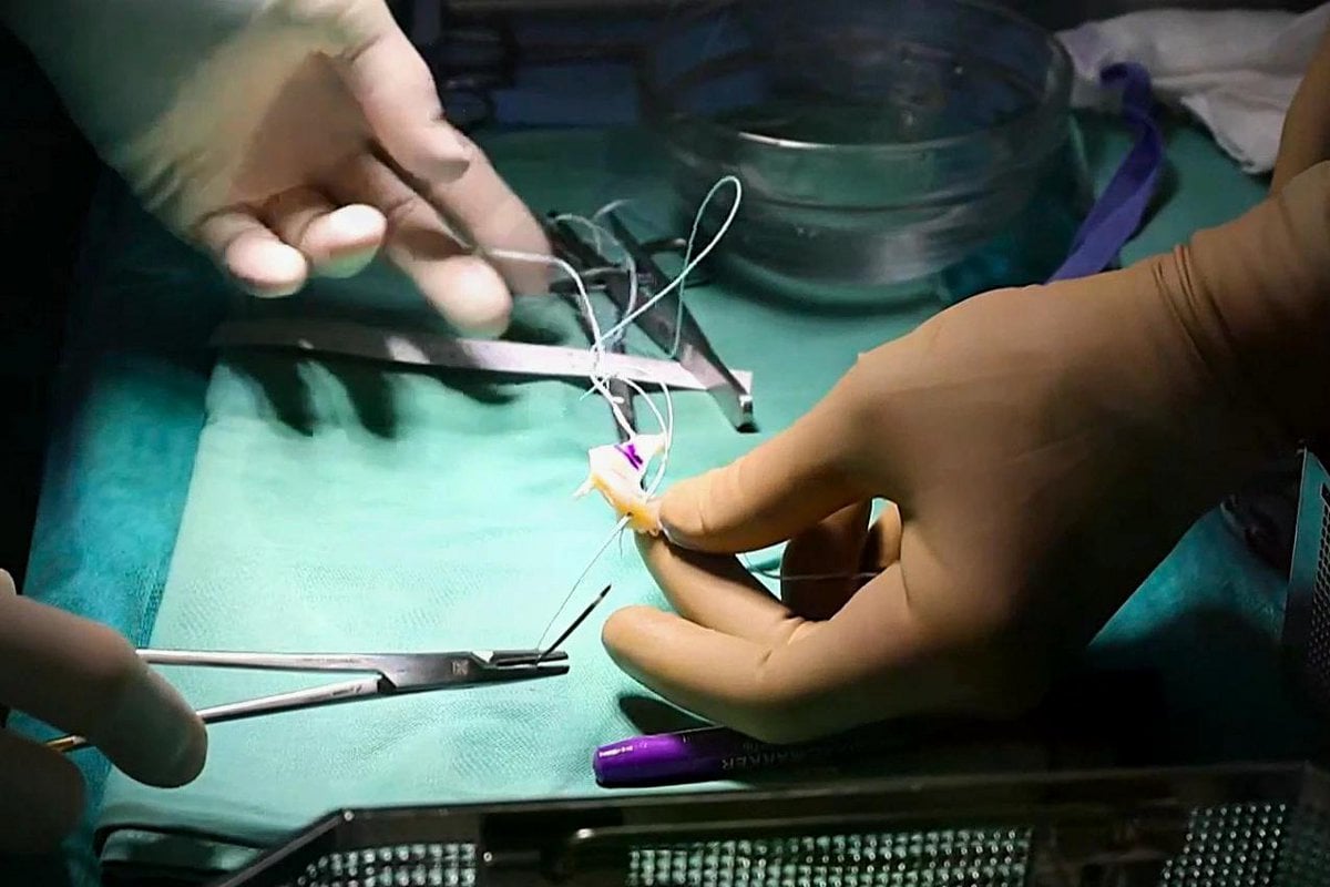 Unikátní operace kolene ve FN Hradec Králové