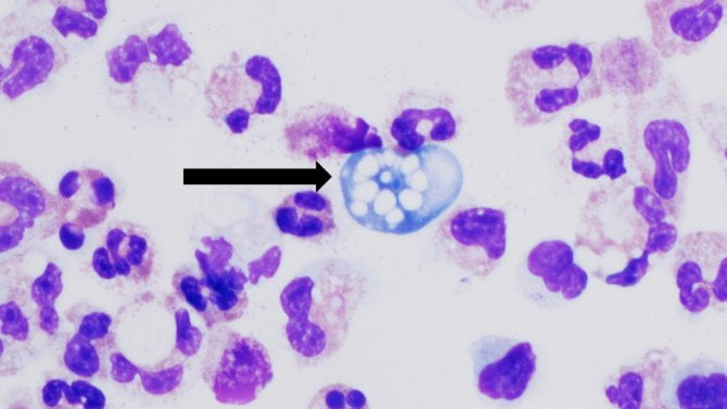 Naegleria fowleri