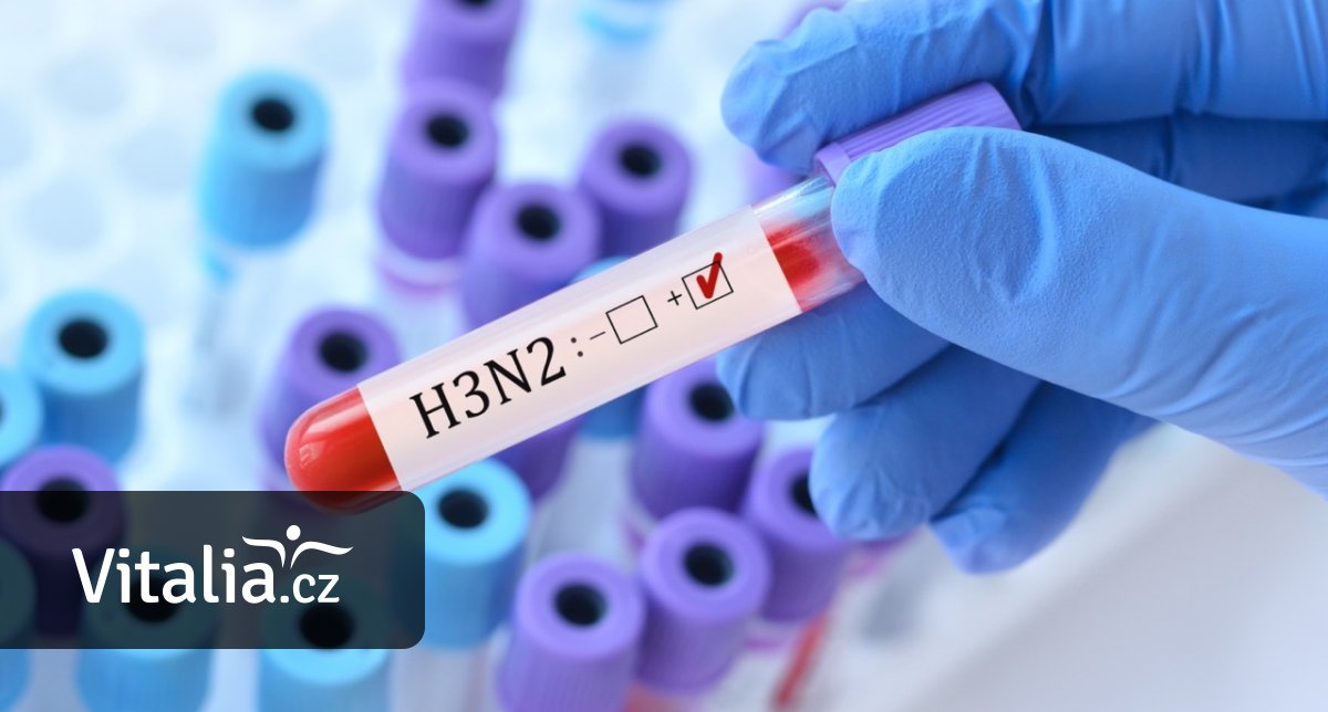 Kdy s chřipkou do nemocnice a kdy ji zvládnete vyležet doma