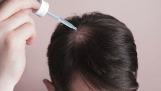 Náhledový obrázek - Dokáže minoxidil zastavit vypadávání vlasů? V některých případech může pomoci, není však vhodný pro každého