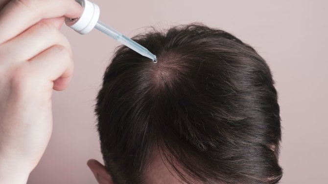 Minoxidil na vypadávání vlasů