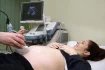 Jedním z nejdůležitějších vyšetření v prvním trimestru je bezpochyby screening, který sestává z ultrazvukového vyšetření a odběrů krve. Tento test má za úkol zjistit výši různých rizik, jako jsou třeba vrozené vady nebo předčasný porod.