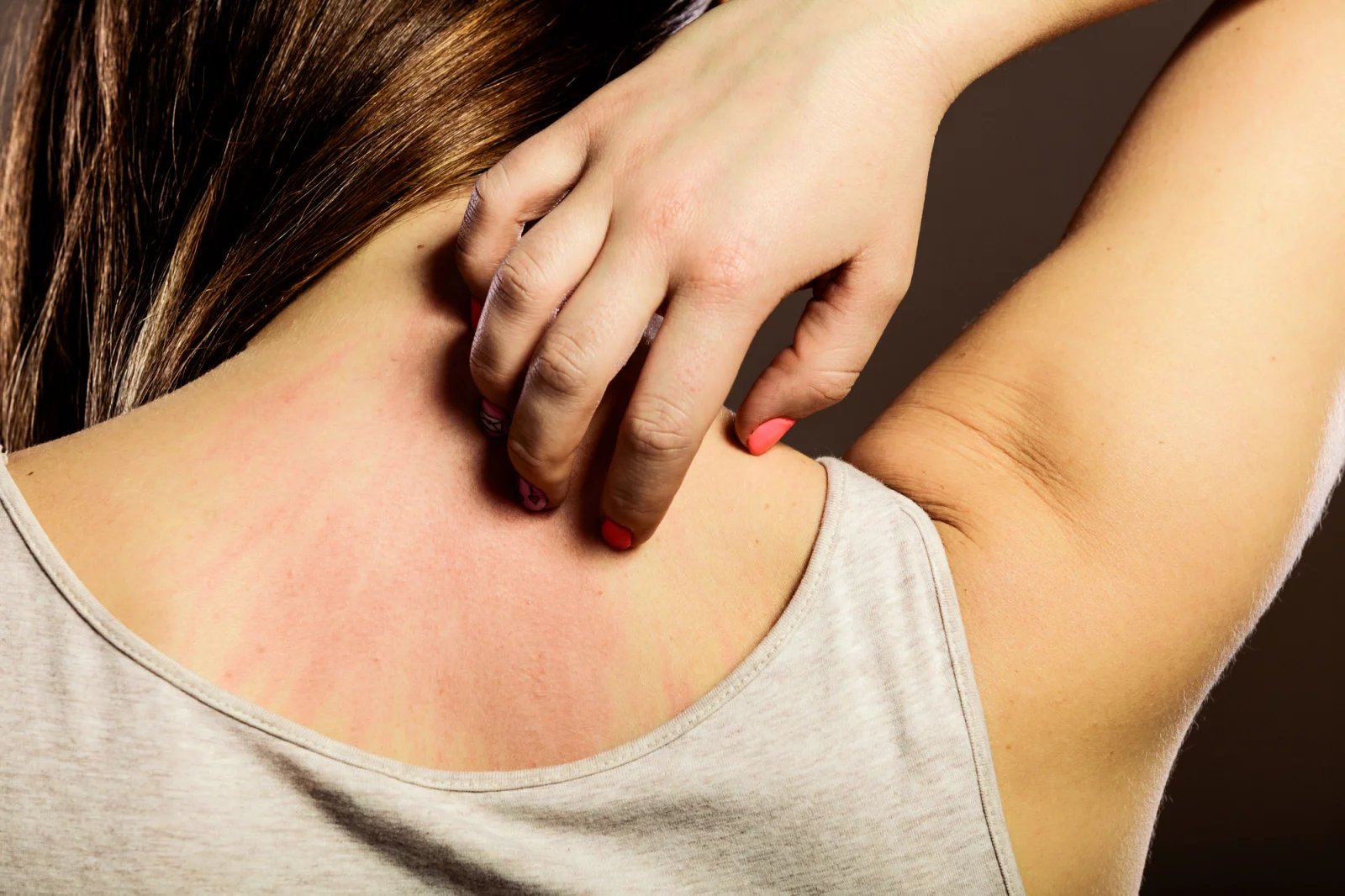 Vyrážka, v lékařských kruzích označovaná jako dermatitida, je opuchlá nebo podrážděná oblast na kůži. V závislosti na příčině pak mohou být dermatitidy bolestivé, pálivé či svědivé.