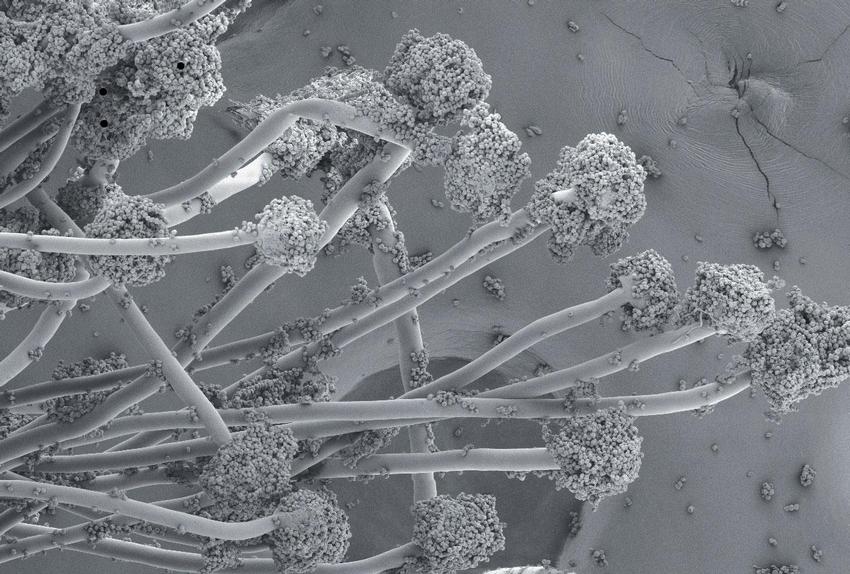 Obr. 4 – Aspergillus niger, obraz v elektronovém mikroskopu. Foto Bc. Martina Tesařová, PAUAV České Budějovice.