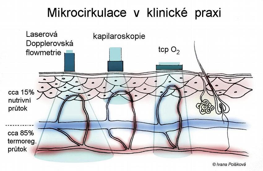 Jak probíhá Kapilaroskopie?