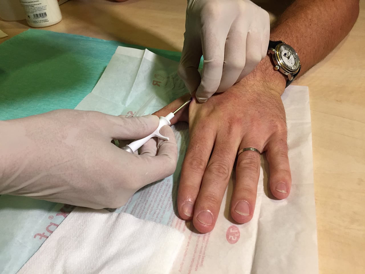 Proces vpichování.