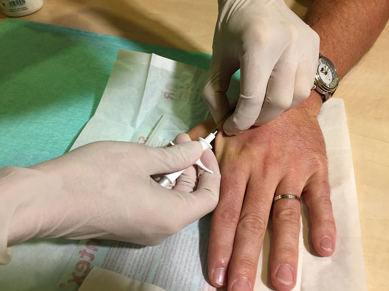 Proces vpichování.