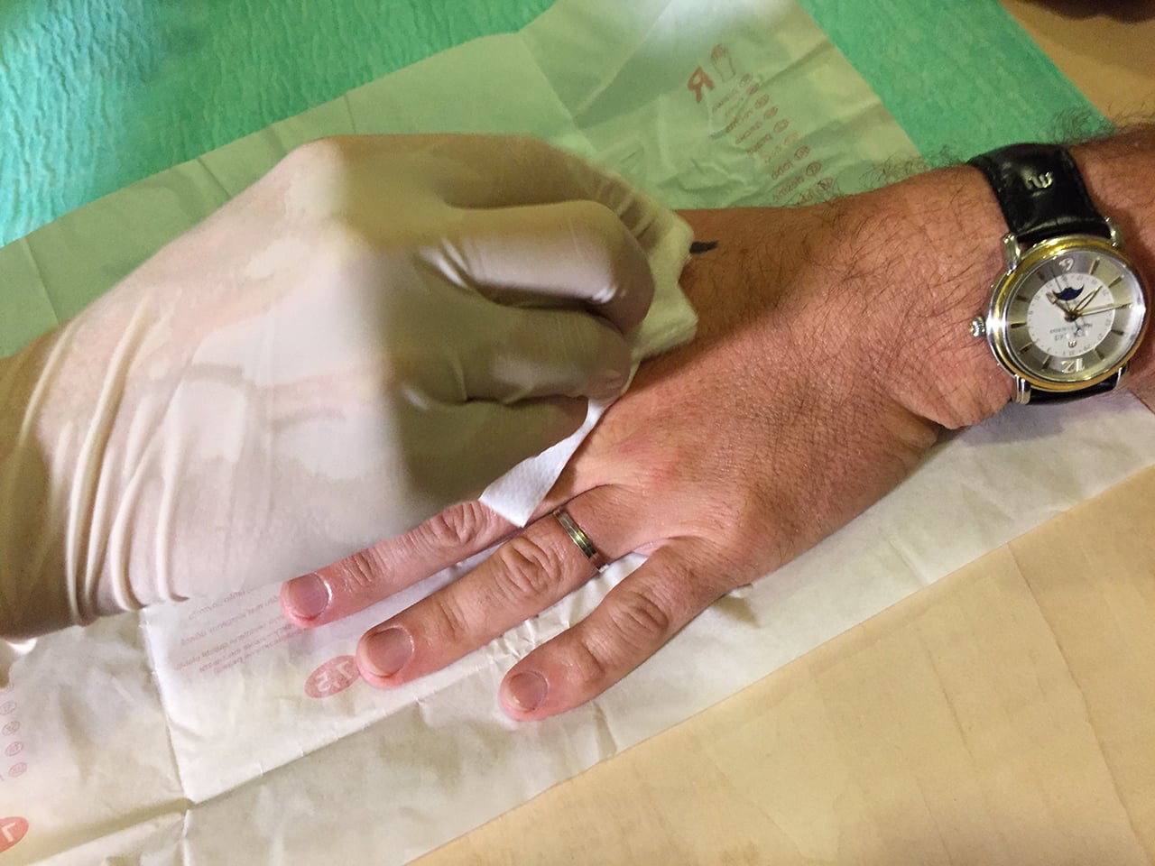 Ošetření po vpichu.