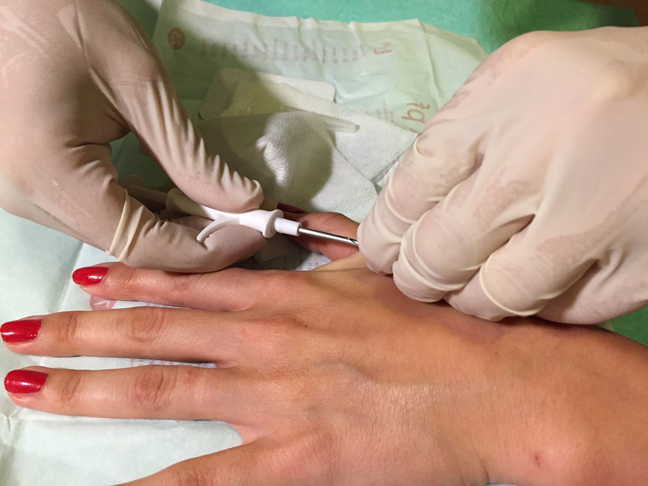 Druhá várka čipování lidí v Česku (16. září 2016, Praha)