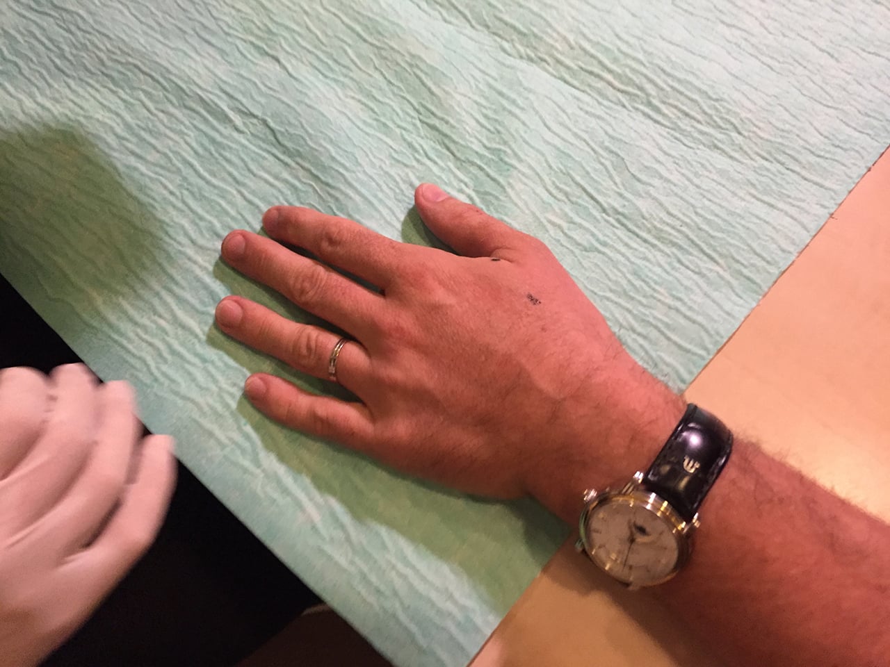 Nakreslená lokalita vpichu.