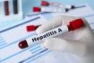 Zkumavka s krví a nápisem Hepatitis A