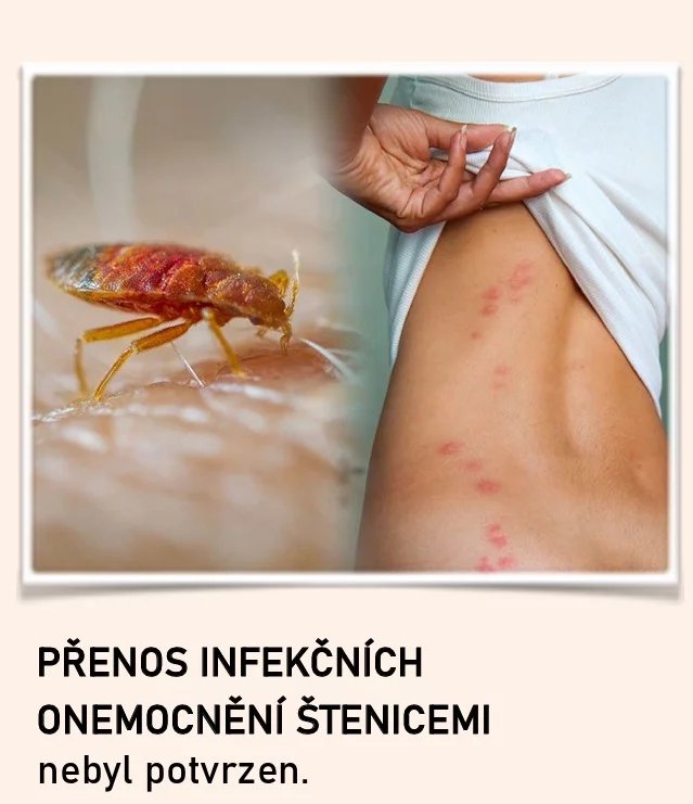 Pražská hygiena vydala informace ohledně štěnic