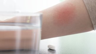 Náhledový obrázek - Borelióza a alkohol nejdou dohromady. Jedním z důvodů je antibiotická léčba