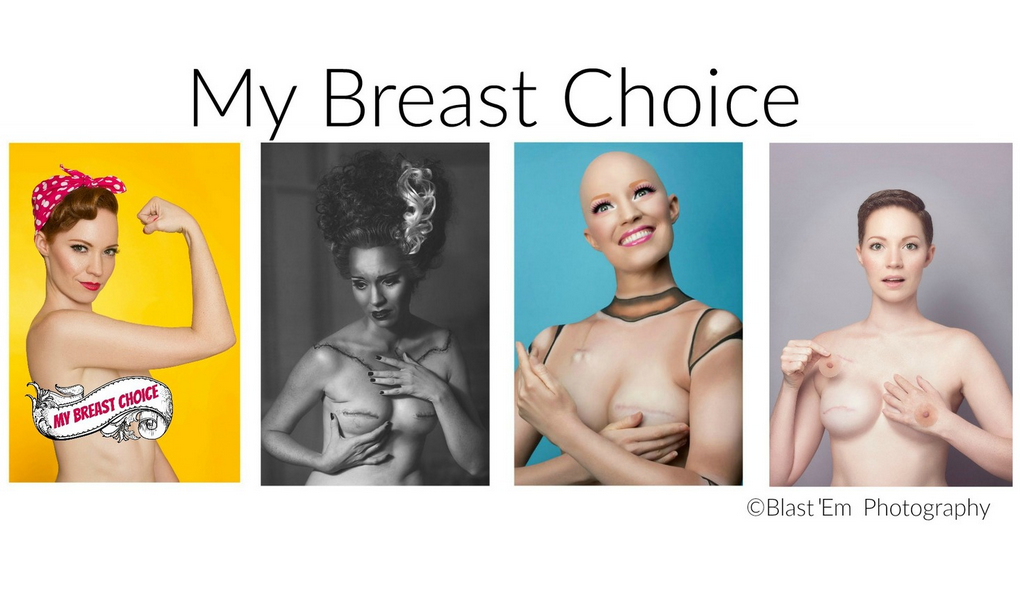 Aniela McGuinness: My breast choice