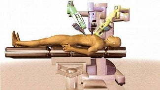 Náhledový obrázek - Jablonecká nemocnice díky dotaci získá přístroje za 150 mil. Kč